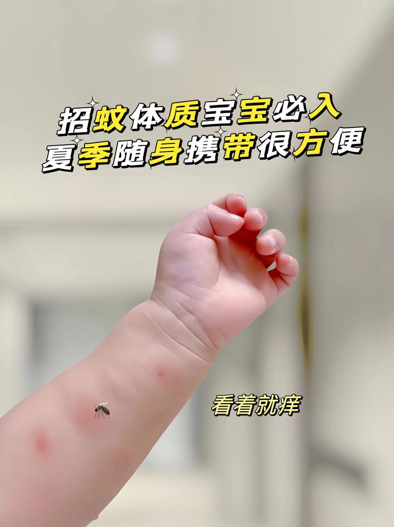 被蚊子咬了很痒,怎么快速止痒?