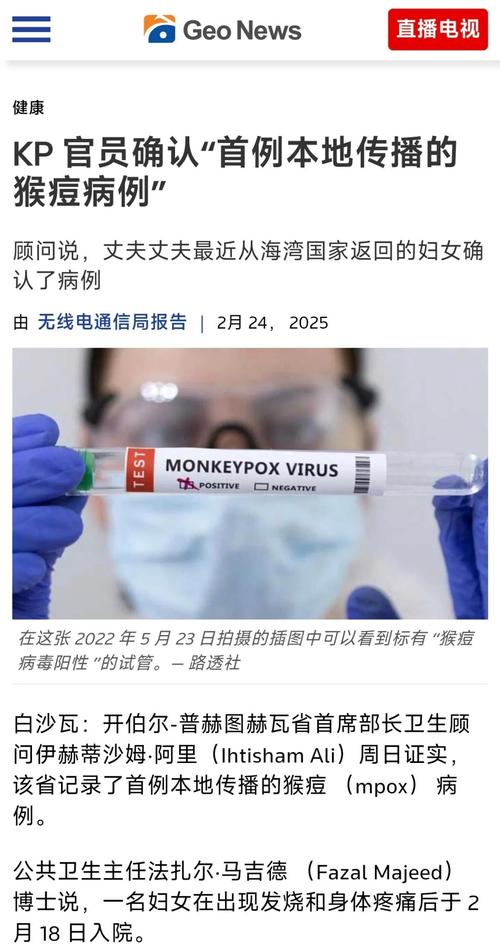 巴基斯坦发现今年首例猴痘确诊病例