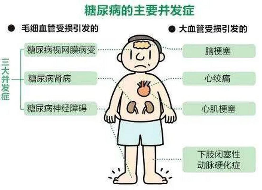 超一半人不知道自己得了糖尿病!出现这些症状要警惕→