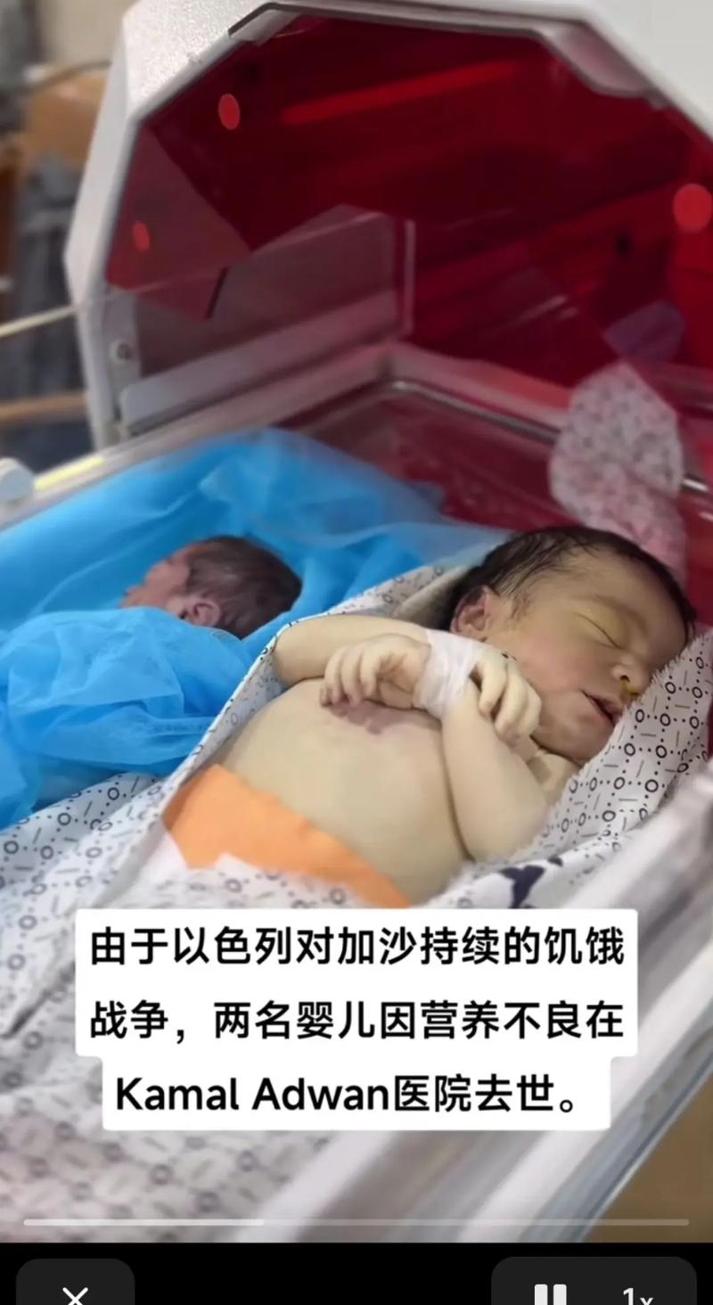 联合国:以军致加沙逾1.3万名儿童丧生 营养不良孩子“无力哭泣”