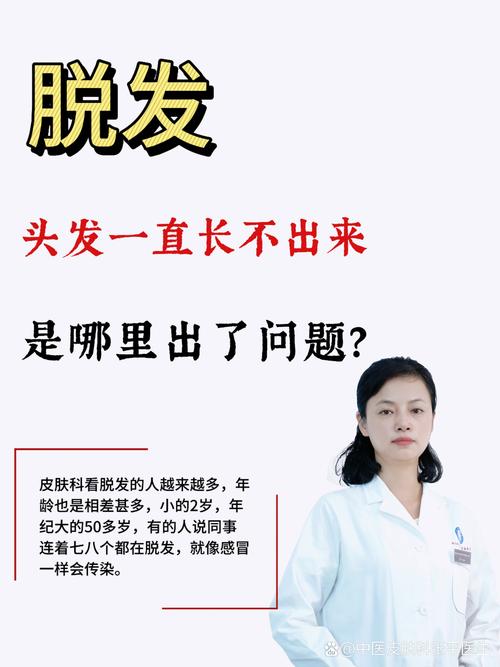 脱发到底因何而生?是因为洗头吗?一篇告诉你脱发真相!