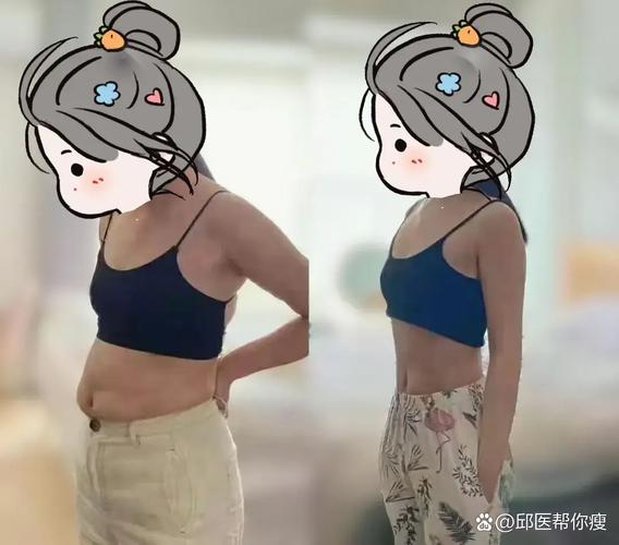 那些一胖就胖肚子的人,后来都怎么样了?
