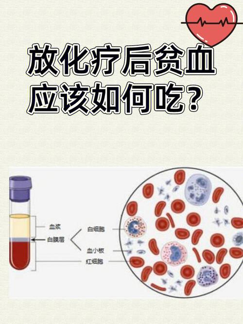 化疗相关性贫血应及时治疗